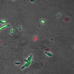 Escherichia coli Zellen kurz nachdem sie dazu gebracht wurden, das  pneumococcal