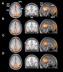 Netzwerk-Veränderungen über den Zeit­raum von 26 Minuten. Die Aus