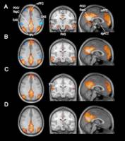 Gehirn ver�ndert neuronale Netzwerke im Schlaf