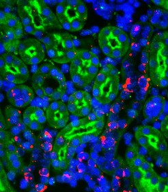 Mikroskopischer Querschnitt durch die Niere. Zu sehen sind Filtrationsröhrc