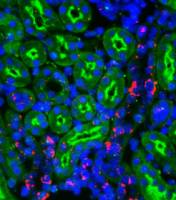 Gendefekt stört Salzhaushalt und treibt Blutdruck in die Höhe
