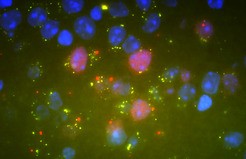 Visualisierung der Insulin-Wirkung in SF-1 Neuronen  des Hypothalamus.  Nach der