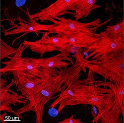 Entwickeln sich im kranken Herzen mit Hilfe von Oncostatin M zurück: Die Ab