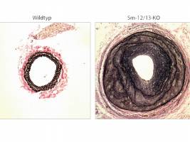 G-Proteine steuern Umbau von Blutgef��en