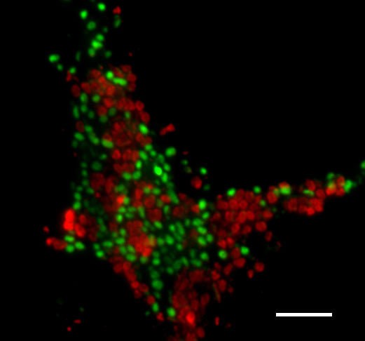 Kulturschale mit anaeroben Methan-oxidierenden Mikroorganismen (Archaeen: rot, B