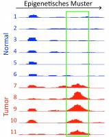 Darmkrebs zeigt bei Maus und Mensch �bereinstimmende epigenetische Muster