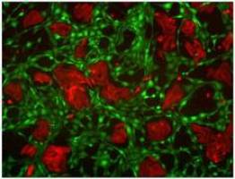 Die Signale zwischen gesunden und b�sartigen Zellen besser verstehen
