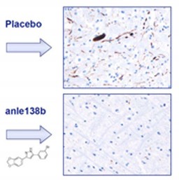 Erhielten Parkinson-M�use den Wirkstoff Anle138b, bildeten sich deutlich weniger