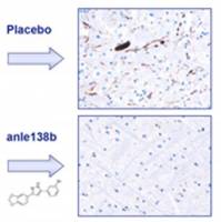 Forscher bremsen Parkinson bei M�usen aus