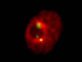 Protein sorgt f�r Ordnung im Zellkern