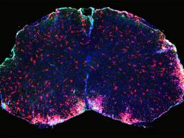 Wirkmechanismus von neuem Medikament gegen Multiple Sklerose entdeckt