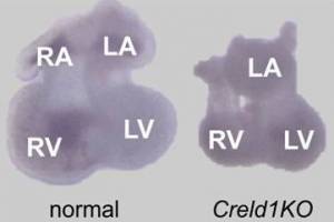 Gen steuert die Entwicklung der Herzklappen