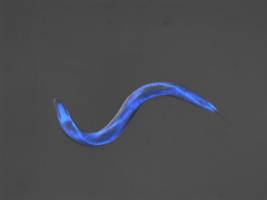 N-Acetylgucosamin verhindert Verklumpung von Proteinen