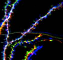 Ged�chtnis braucht keine dauerhaften Synapsen im Hippocampus