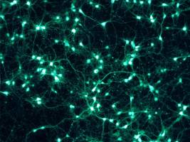 Kein Kabelsalat im Gehirn