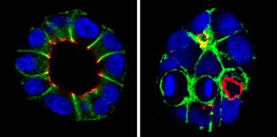Nierenversagen: Ortungssignal f�r die Zellteilung