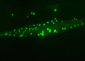 Proteinaggregate sch�tzen Zellen im Alter