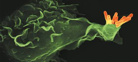 Tuberkulose-Forschung kommt in Fahrt