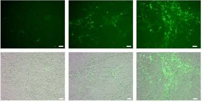 Von der Stammzelle zur Nervenzelle in wenigen Wochen