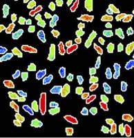 Bakterien sind Individualisten