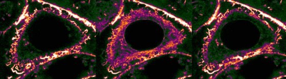 CaAR in einer Brustkrebszelle nach mechanischer Verletzung (Perforierung) der Pl