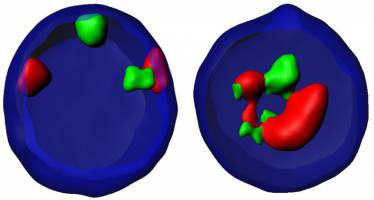 Stammzellen unter Zugzwang