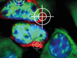 Warum Nervenzellen sterben