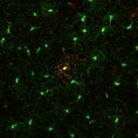 Abwehrzellen im Gehirn leben l�nger als gedacht