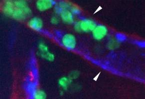 Basement membrane protein influences the connection of blood vessel cells: Tracking inflammatory processes / Study produced by researchers at Cells-in-Motion Cluster of Excellence