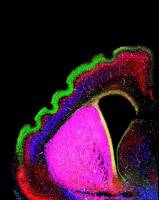 Die Entstehung der Falten in der Hirnoberfl�che