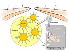 Forscher entschl�sseln einen Mechanismus bei schweren Hautinfektionen