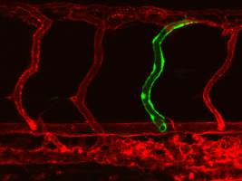 Gendefekt vergrößert Endothelzellen und führt zu Gefäßmissbildungen
