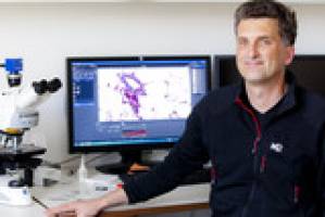 MHH-Forscher entdecken Mechanismus, der Zellwachstum in Blutgef��en hemmt