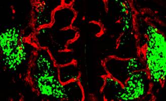 Motoneuronen zeigen den Blutgef��en, wo es lang geht