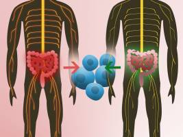 Nat�rliche Darmflora kann Multiple Sklerose ausl�sen