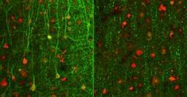 Neues Verfahren erm�glicht die Kultivierung menschlicher Gehirnschnitte in der Petrischale
