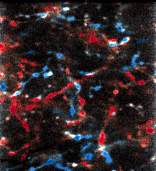 Nicht nur Nervenzellen der Sehrinde, sondern auch Thalamus-Zellen ver�ndern ihre