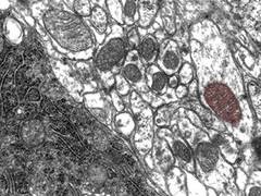 Zellen im Elektronenmikroskop. Ein Mitochondrium einer Zelle wurde nachtr�glich 
