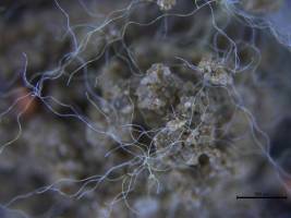 Mikroplastik: eine Gefahr f�r den Erdboden?