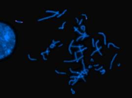 Chromosomale Erkrankungen besser erkennen