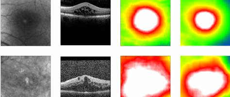 Deep-learning in hospitals