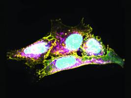 Erbanlage bewahrt Immunsystem vor Alterung