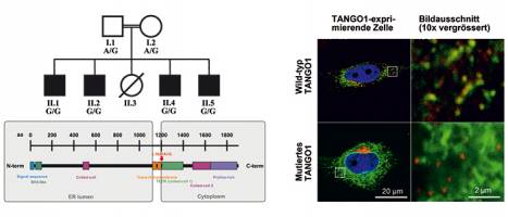 Gestörte zelluläre Kollagen-Sekretion hat große Auswirkungen
