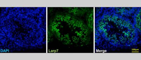 Kleine Mutation mit schwerwiegenden Folgen