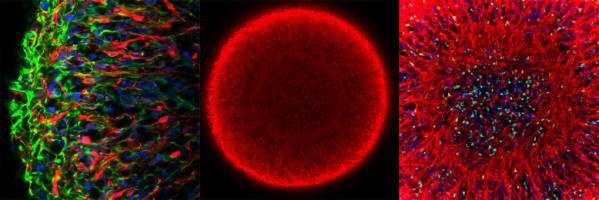 Mittelhirn-Organoide f�r automatisierte Wirkstoff- und Krankheitsforschung