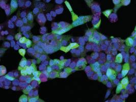 Neue Methode erlaubt exakte Genkontrolle durch Licht