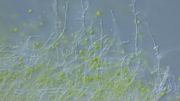 Pilz bietet Schutz gegen bakteriellen Angreifer