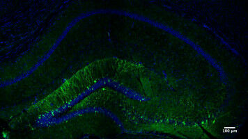 Selectively Reactivating Nerve Cells to Retrieve a Memory