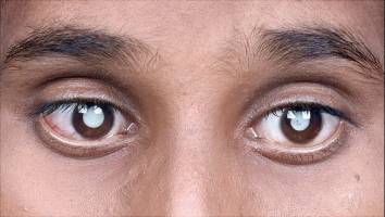 Wahrnehmungsverzerrungen entstehen schon in der Kindheit