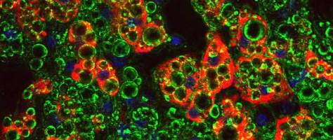 Wie Fettzellen entstehen, die Kalorien verbrennen